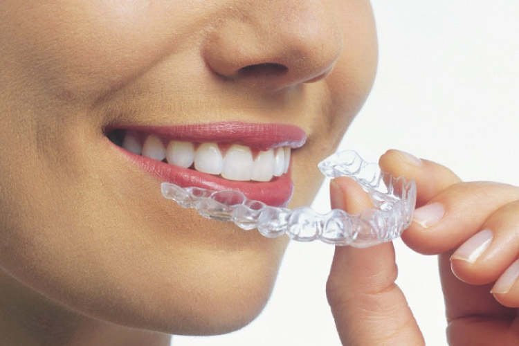 What Orthodontic Issues Can't Invisalign Fix? Helotes Dentist