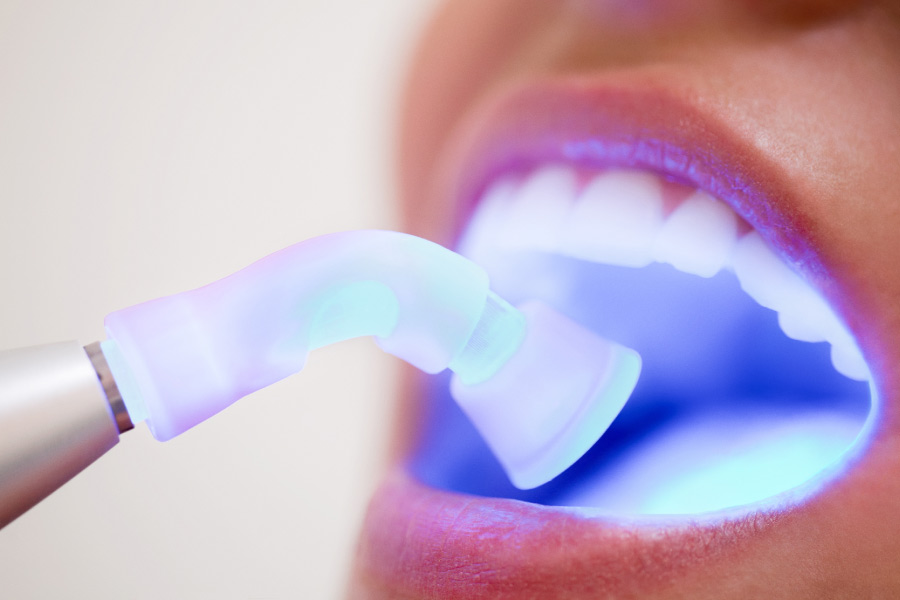 Blue light inside a patient's mouth screening for oral cancer.